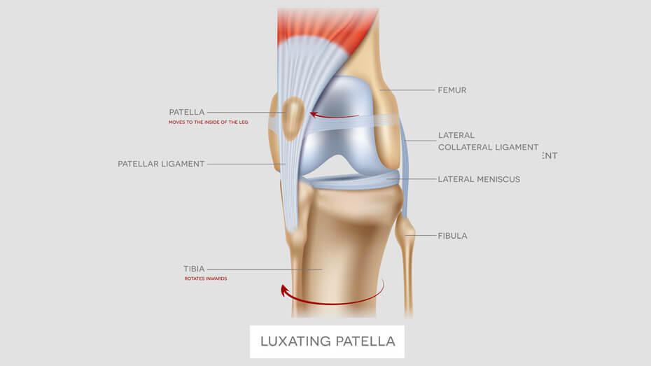 Luxating Patella in Dogs Symptoms and Treatment2 Luxating Patella